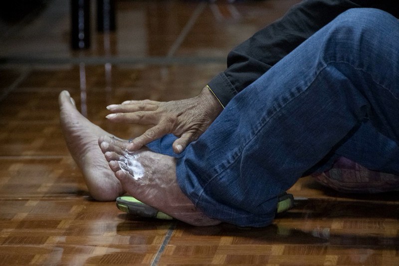 رابطة طبية تحذر من أمراض مرتبطة بـ"برودة الأقدام"